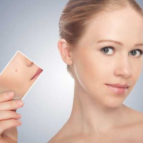 acne-de-la-peau