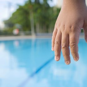 enfant-eczema-piscine