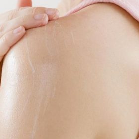 sante-cortisone