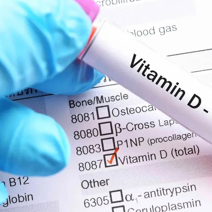 vitamin-D_